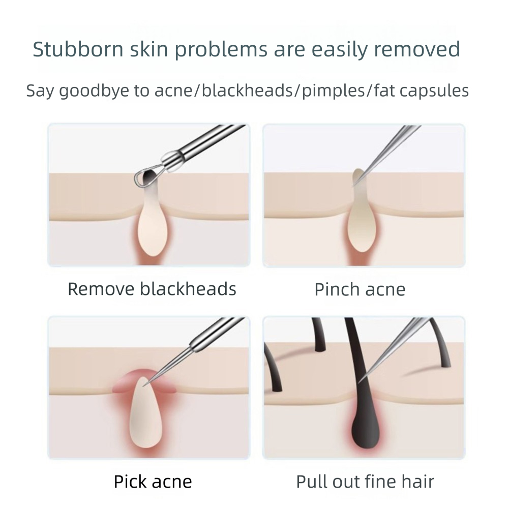 3-5 قطعة ملاقط الشعر نام حب ال - مراجعة Hair Care Clinic وسعره
